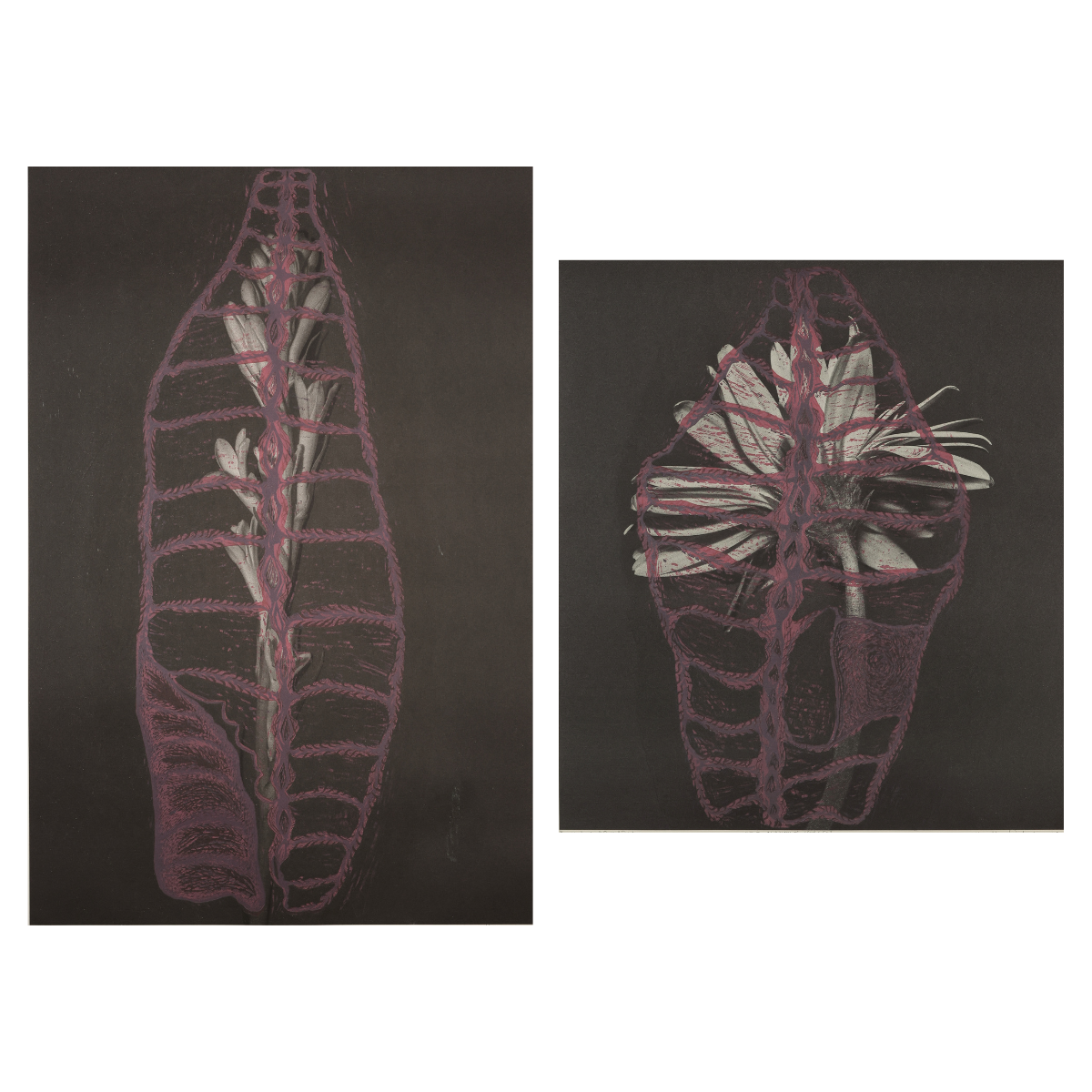 Anatomy of a Savage (Set of 2)